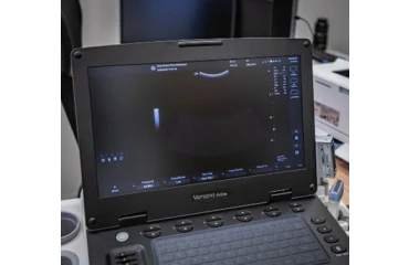 Korszerű, hordozható ultrahangkészülékkel bővítette eszközparkját a SZEI